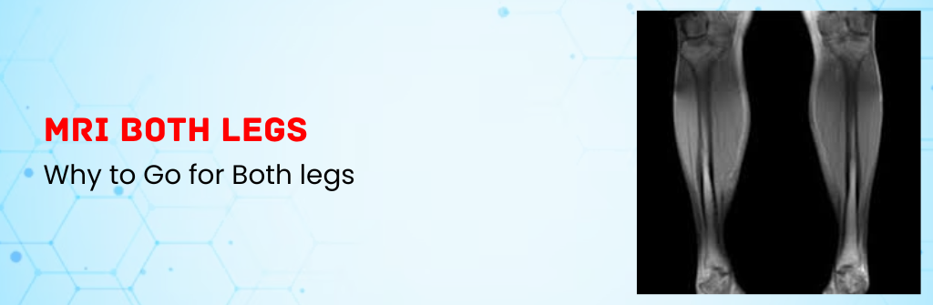  Why to Go for MRI Both legs